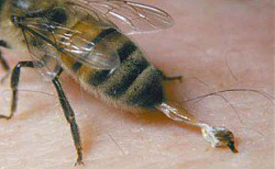 Жена почина след ужилване от пчела в Бургас
