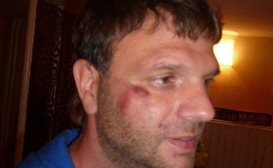 Мъж се оплака от полицейско насилие в София