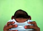 Първи случай в Европа на бебе с микроцефалия заради вируса Зика