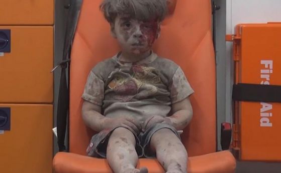 Малкият Омран от Алепо, който разплака света (СНИМКИ)