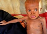 Всеки ден 130 деца умират от глад и болести в Йемен