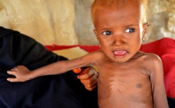 Всеки ден 130 деца умират от глад екстремно недохранване и