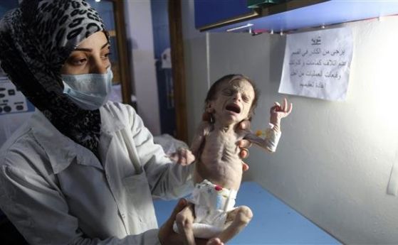 Отчетоха най-тежкото недохранване на деца в Сирия от началото на войната