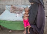 85 000 деца в Йемен може да са починали от недохранване