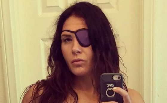 Дама от ММА обжалва загуба заради травма на окото
