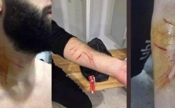 Турски футболист рязал съперници с бръснарско ножче