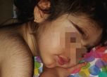 Деца със Синдром на върколака в Испания заради замърсено лекарство