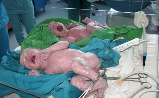 Лекари от Майчин дом спасиха родилка и близнаците ѝ, акушерките я изненадаха за рождения ден