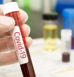 Пациентка за COVID-19: Болест, която не прилича на никоя друга