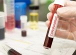 Провалиха се клиничните тествания на противовирусния препарат ''Ремдезивир''