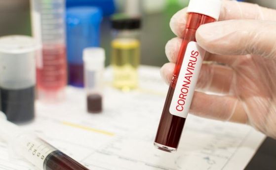 Провалиха се клиничните тествания на противовирусния препарат ''Ремдезивир''