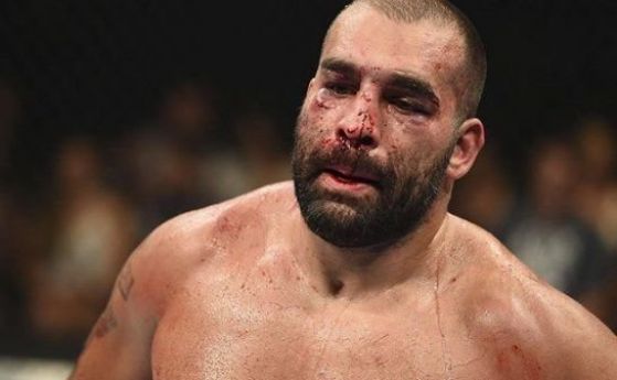 Багата записа втора поредна загуба в UFC
