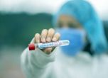 СЗО отчете пореден скок на заразените с коронавирус