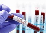 146 нови случаи на коронавирус от близо 4000 теста, двама са починали