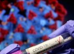 39 новозаразени с коронавирус от 1 407 PCR теста