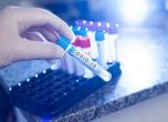 Новите случаи на COVID-19 са повече при по-малко PCR тестове