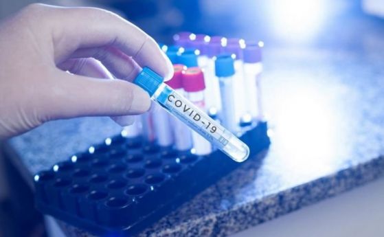 Само 27 са новите случаи на коронавирус, но и тестовете са под 1000
