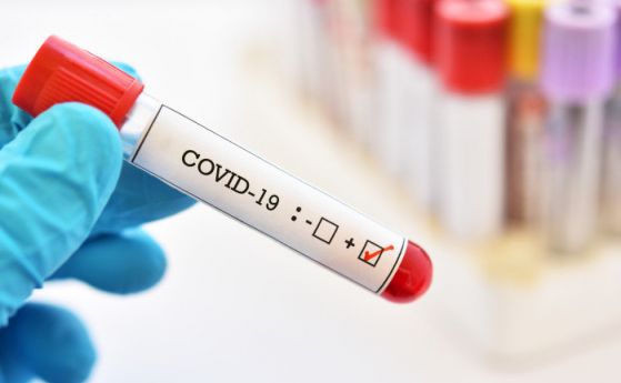 154 са новите случаи на COVID-19 у нас, още 10 души починаха