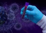 3712 новозаразени с коронавирус - 42,08% от тестваните, 141 са починали
