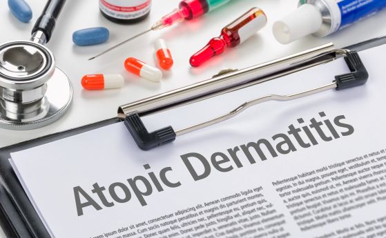 EК одобри ново лекарство за лечение на атопичен дерматит