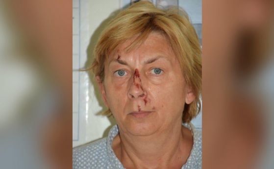 Полицията установи коя е жената с амнезия от остров Крък