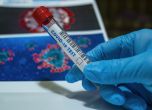 523 нови случая на коронавирус, положителните проби са 10,7%