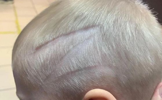 Руски фризьори обръснаха буквата Z на слепоочието на 4-годишно дете без разрешение