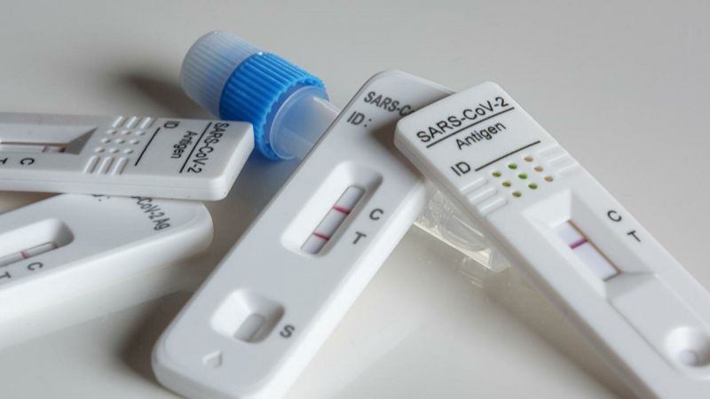 Националната здравно-осигурителна каса ще заплаща бързите антигенни тестове при общопрактикуващите