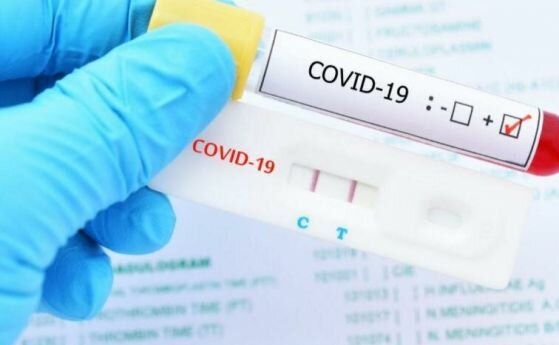 24% от изследваните са с COVID-19