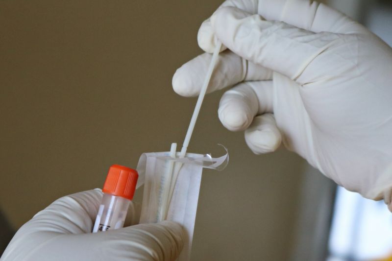 777 са новите случаи на коронавирус, потвърдени при направени 5 635
