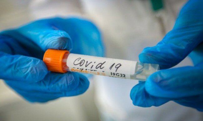 Новите случаи на заразени с COVID-19 са 198 за последното