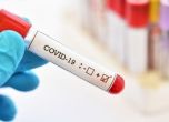 73 са случаите на заразени с COVID-19, няма починали