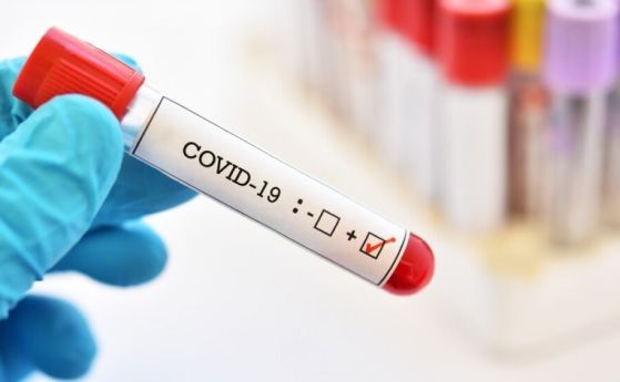 45 са новите случаи на COVID-19 у нас