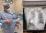 Сапьори край операционната маса. Хирурзи извадиха невзривена граната от тялото на украински боец