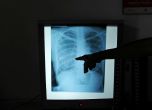 Един туберкулозно болен може да зарази 20 души за година