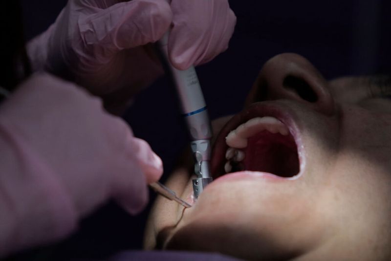 зъболечение