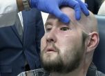 За първи път: Хирурзи присадиха око