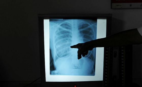 рентгенова снимка