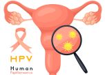 Жените с висок риск от HPV са по-застрашени от сърдечно заболяване