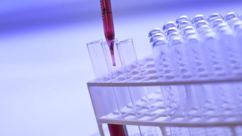 За пръв път в бюджета за НЗОК се отпускат пари за диагностика с биомаркер