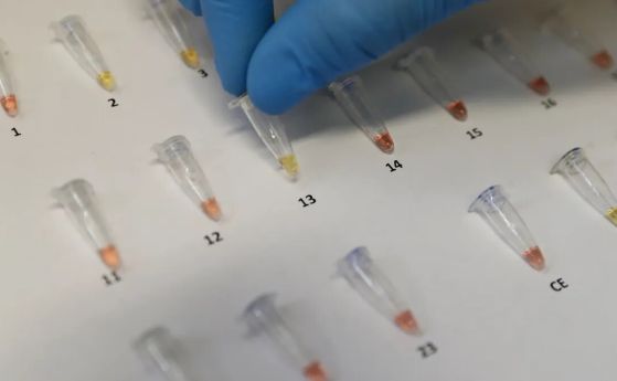 Забравената болест се завръща: Туберкулозата отново застрашава света