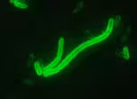 Yersinia pestis, пряк флуоресцентен метод с антитела (DFA)