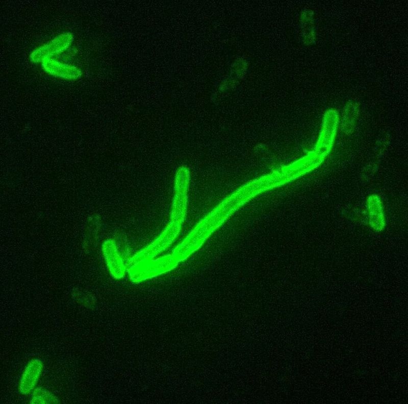 Yersinia pestis, пряк флуоресцентен метод с антитела (DFA)