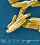 Туберкулозната бактерия