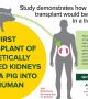 Успешна трансплантация на два бъбрека от генетично модифицирано прасе в човек (видео)