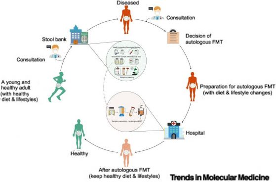 Схема на автоложна трансплантация на фекална микробиота (FMT)